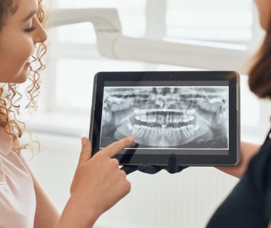 Implants dentaires numériques : la technologie au service de votre confort